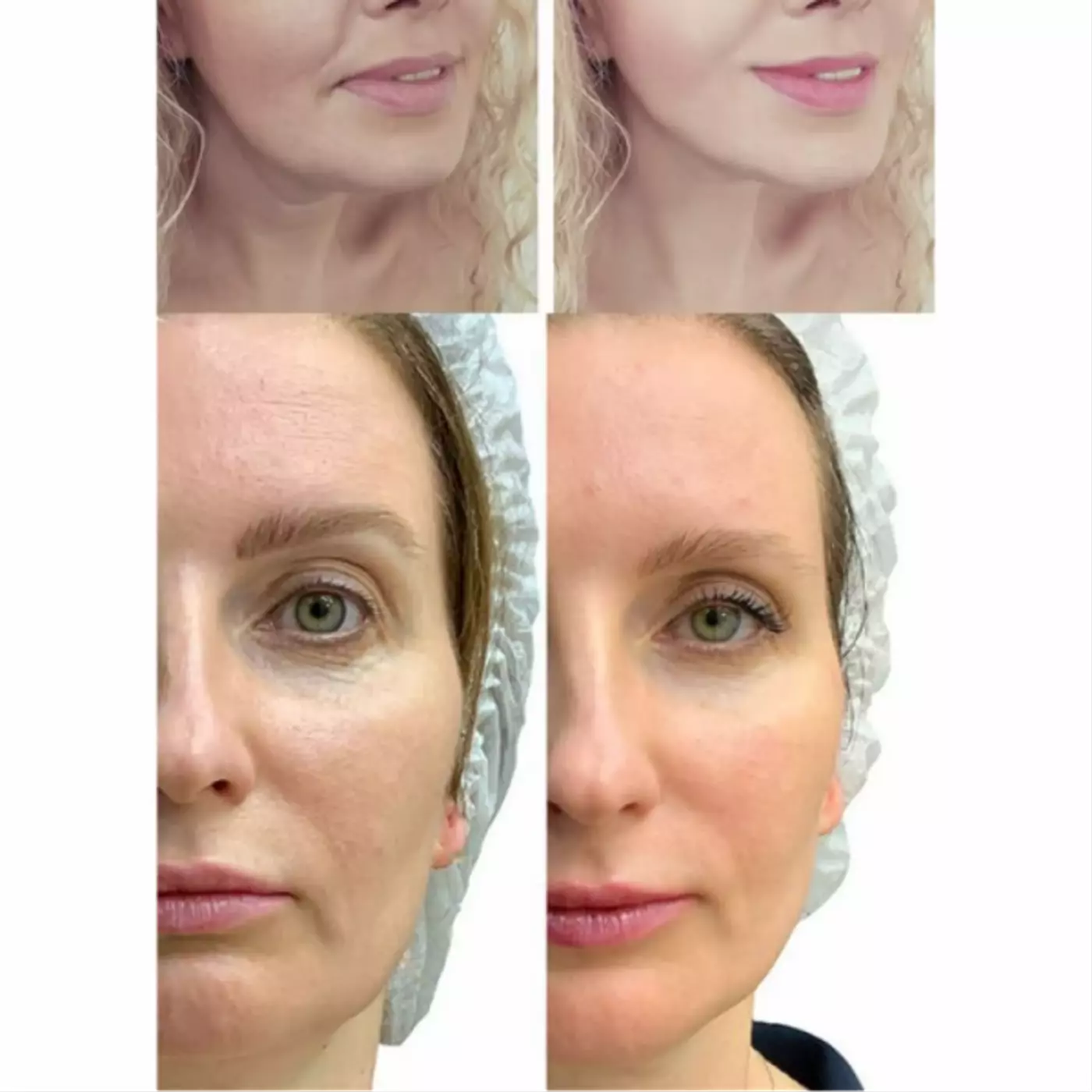 МІКРОСТРУМОВИЙ RF ЛІФТИНГ-МАСАЖЕР ДЛЯ ОБЛИЧЧЯ MEDICA+ SKIN LIFTING 7.0 WHITE ЯПОНІЯ (EMS+LED)