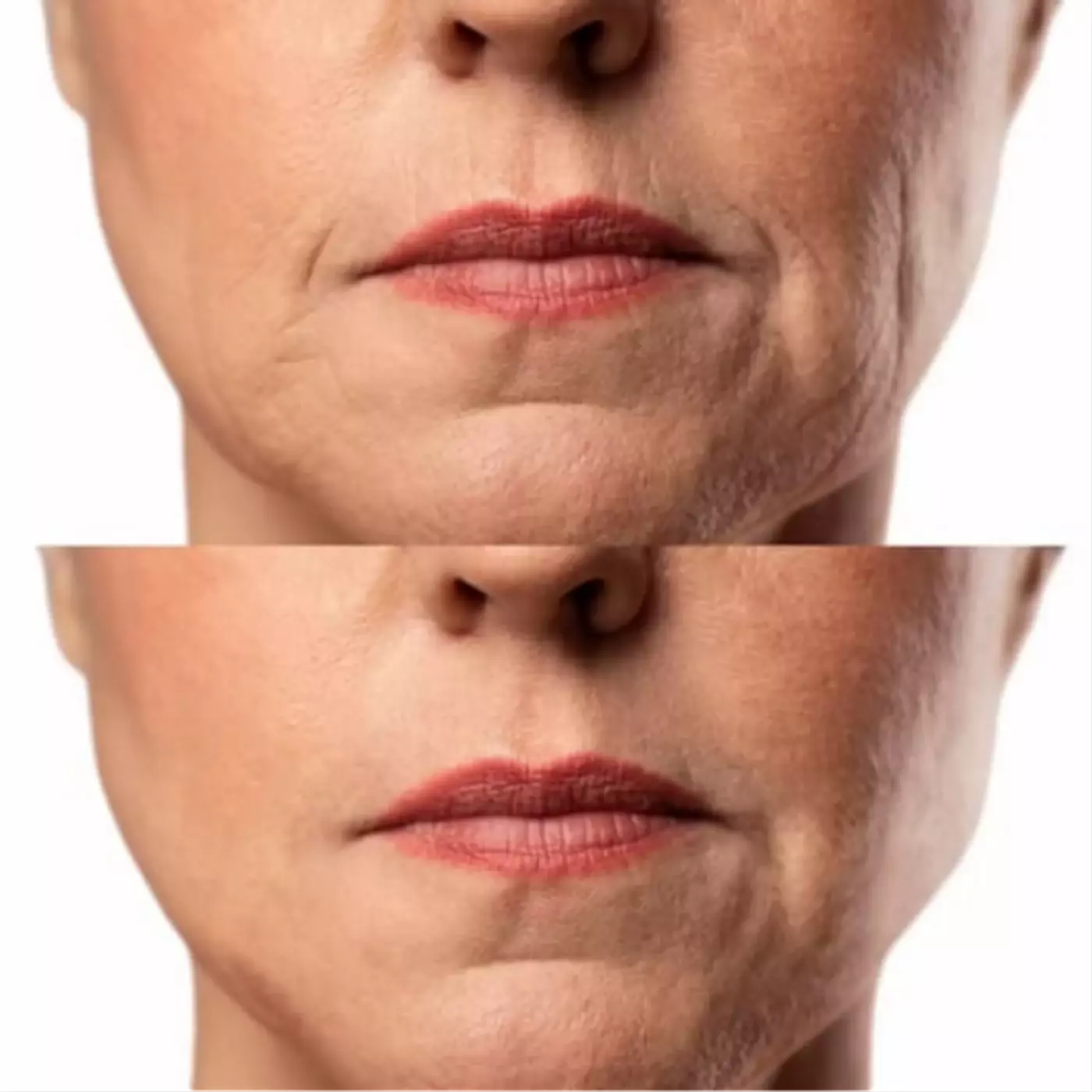 МІКРОСТРУМОВИЙ RF ЛІФТИНГ-МАСАЖЕР ДЛЯ ОБЛИЧЧЯ MEDICA+ SKIN LIFTING 7.0 WHITE ЯПОНІЯ (EMS+LED)
