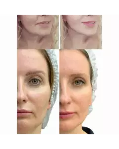 МІКРОСТРУМОВИЙ RF ЛІФТИНГ-МАСАЖЕР ДЛЯ ОБЛИЧЧЯ MEDICA+ SKIN LIFTING 7.0 PINK ЯПОНІЯ (EMS+LED)